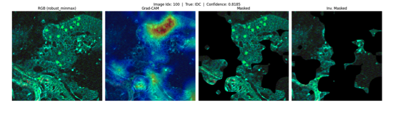 LAMPE: Prostate Cancer Detection-banner